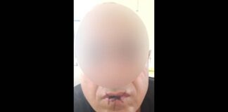 Nauru refugee sews his lips and begins hunger strike