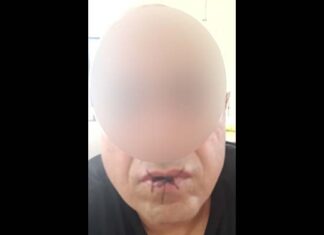 Nauru refugee sews his lips and begins hunger strike